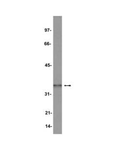Polyclonal Rabbit anti-Human HOXA9 Antibody (aa194-272, IF, WB)