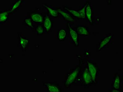 ZFP42 / REX-1 Antibody