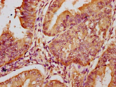 LTN1 / RNF160 Antibody