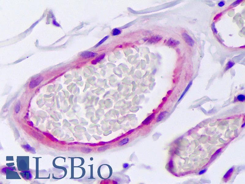 IHC-plus™ SERPINE1 / PAI-1 Antibody
