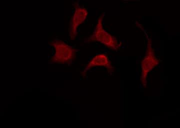 OR52W1 Antibody