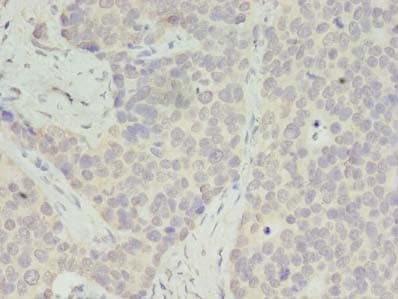 Polyclonal Rabbit anti-Human RPS28 / Ribosomal Protein S28 Antibody (IHC)