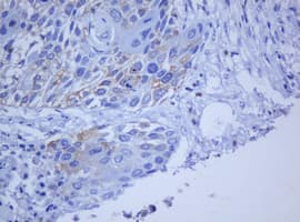 BCL10 / BCL-10 Antibody (clone OTI9C2, Carrier-free)