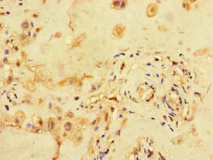 MED1 / TRAP220 Antibody