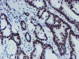 METTL16 / METT10D Antibody (clone OTI3B5)