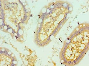 CSRP2BP Antibody (aa523-782)