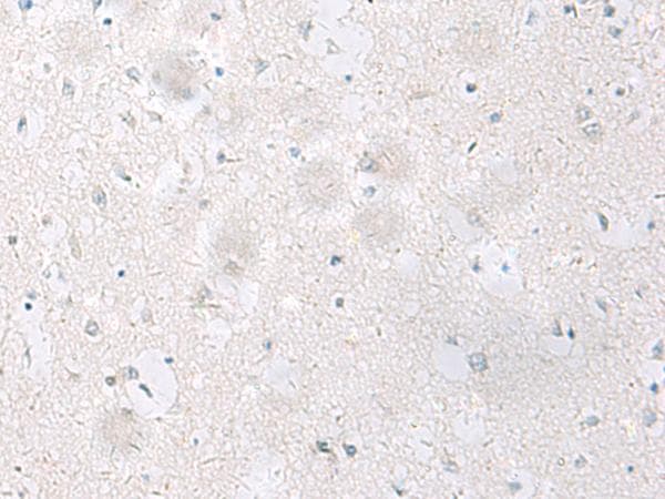 SST / Somatostatin Antibody
