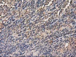 HDAC6 Antibody (clone OTI3E7)