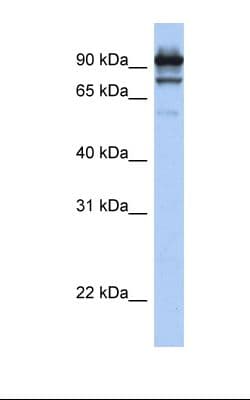 Polyclonal Rabbit anti-Human STAT6 Antibody (aa614-663, IHC, WB)