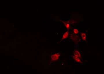 NIP45 / NFATC2IP Antibody
