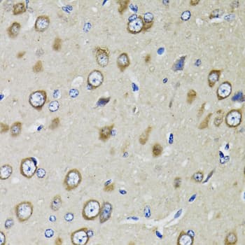 RPS10 / Ribosomal Protein S10 Antibody