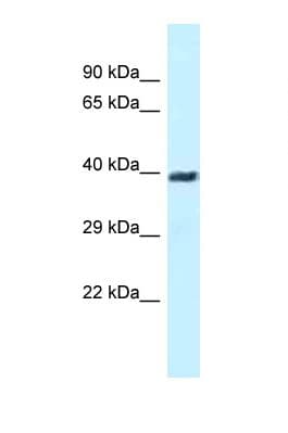 MTA3 Antibody (aa54-103)