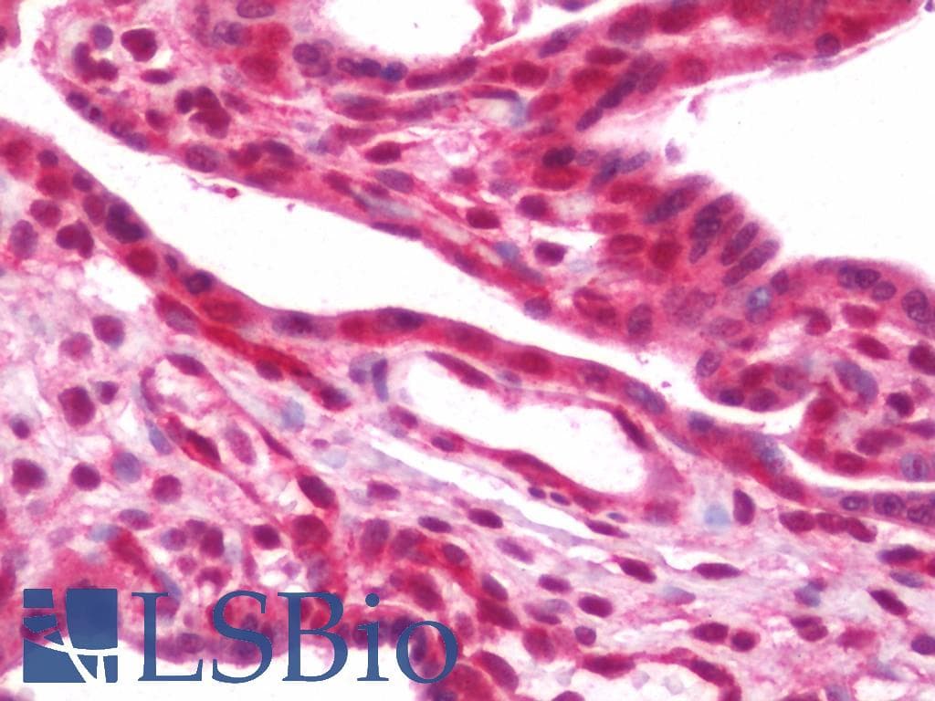 IHC-plus™ Polyclonal Rabbit anti-Human EIF5A2 Antibody (aa78-127, IHC, WB)
