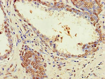 ZNF844 Antibody