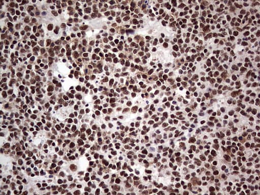 SAE1 Antibody (clone OTI3C3)
