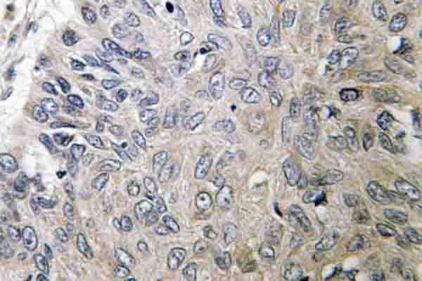 Polyclonal Rabbit anti-Human BCAR1 / p130Cas Antibody (Val404, IHC, WB)