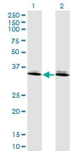 DLX6 Antibody (clone 2D7)