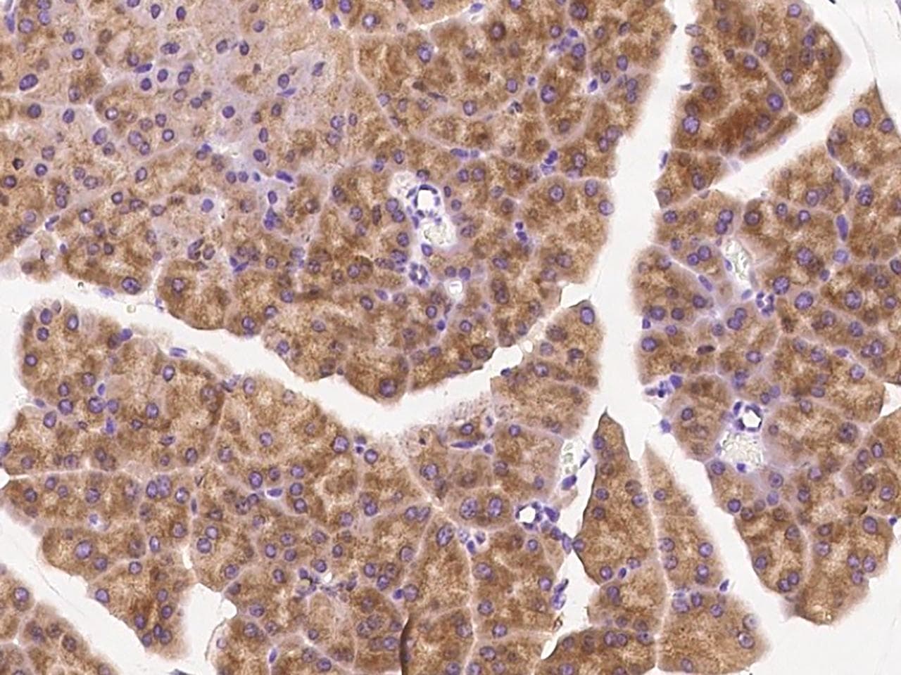 KLK7 / Kallikrein 7 Antibody (Preservative Free)