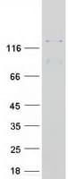 Human PKN2 Protein (Recombinant Myc-DDK (Flag))