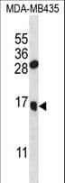 GNLY / Granulysin Antibody (aa14-42)