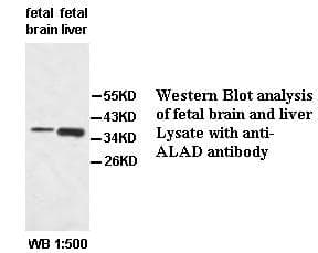 Polyclonal Rabbit anti-Human ALAD Antibody (IHC, WB)