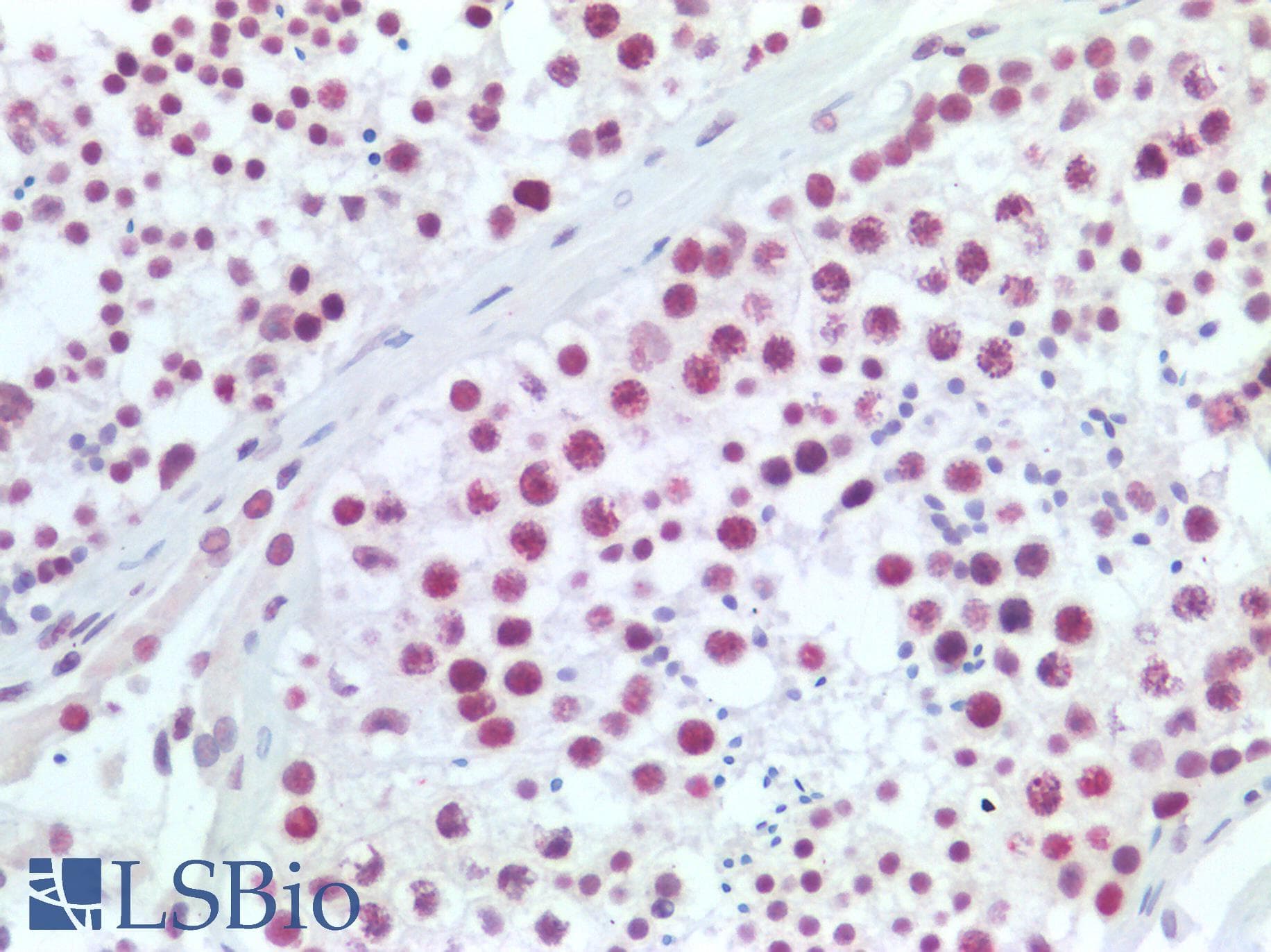 PathPlus™ IKZF1 / IKAROS Antibody
