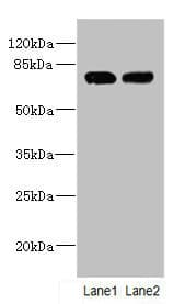 Polyclonal Rabbit anti-Human KLHL13 Antibody (IHC, WB)