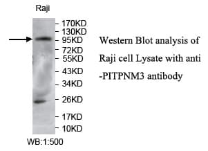 PITPNM3 / NIR1 Antibody (aa237-478)