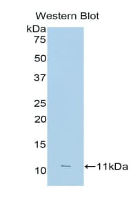 FCGR3A / CD16A Antibody (aa26-108)