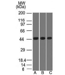 NAPSA / NAPA / Napsin A Antibody (clone NAPSA/1238 + NAPSA/1239, Ready-to-Use)