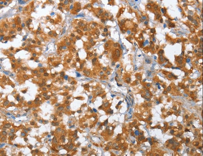 TP53BP2 / ASPP2 Antibody