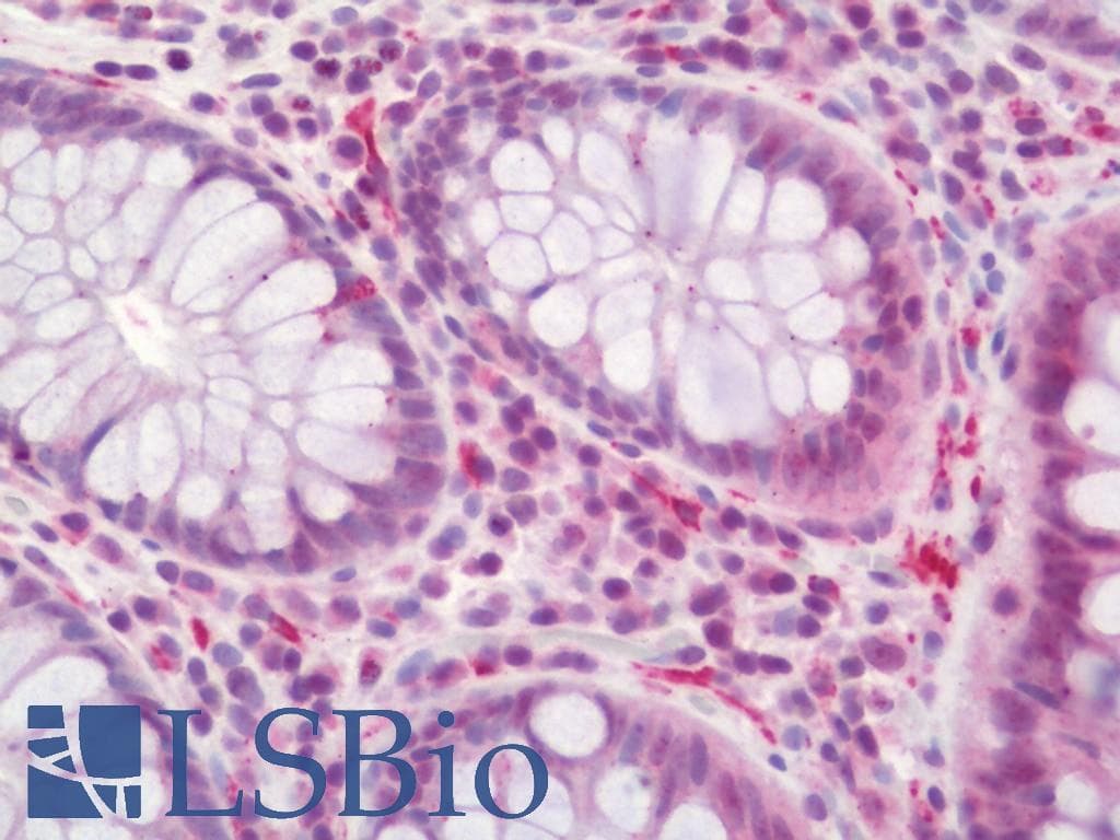 IHC-plus™ CNOT4 / CLONE243 Antibody (aa61-110)