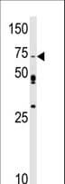 SRPK1 Antibody (aa1-30)