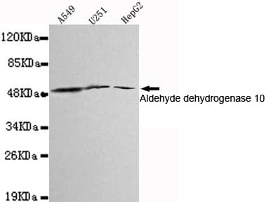 ALDH3A2 Antibody