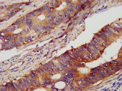 Polyclonal Rabbit anti-Human PCSK2 Antibody (IHC, WB)