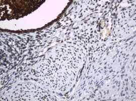 Monoclonal Mouse anti-Human WFDC2 / HE4 Antibody (clone OTI1E12, aa31-124, IHC, WB)