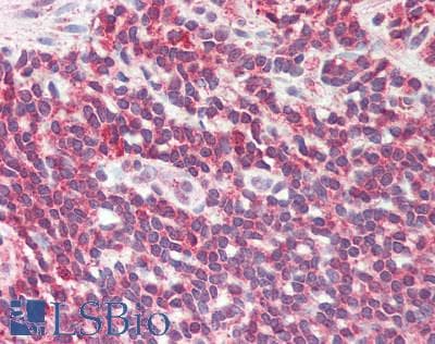 IHC-plus™ Polyclonal Rabbit anti-Human DEFB4A / BD-2 Antibody (aa1-64, IHC)