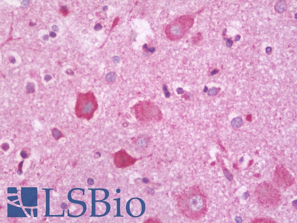 IHC-plus™ PLXNC1 / Plexin C1 Antibody (aa1025-1054)
