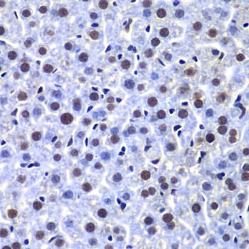 Polyclonal Rabbit anti-Human PRKDC / DNA-PKcs Antibody (IHC, WB)