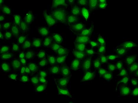 SULT2B1 / Sulfotransferase 2B1 Antibody