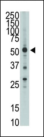 HTRA1 Antibody (aa116-147)