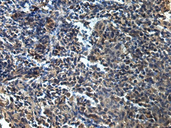 AMOG / ATP1B2 Antibody