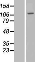GAA / Alpha-Glucosidase, Acid Protein (Over-Expression Lysate Myc-DDK (Flag))