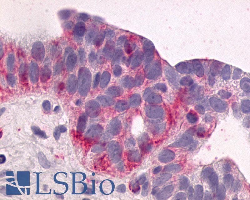 PathPlus™ NTSR1 / NTR Antibody (Cytoplasmic Domain)