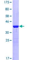 Human DNMT / DNMT1 Protein (Recombinant GST, N-terminus)
