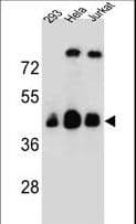 OR4C13 Antibody (aa60-89)