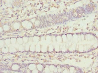 IP6K2 Antibody