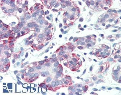 COL17A1 / Collagen XVII Antibody (aa184-375)