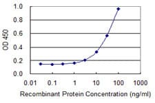 IHC-plus™ ATP6E / ATP6V1E1 Antibody (clone 4E11)