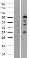 ALOX12 / 12 Lipoxygenase Protein (Over-Expression Lysate Myc-DDK (Flag))